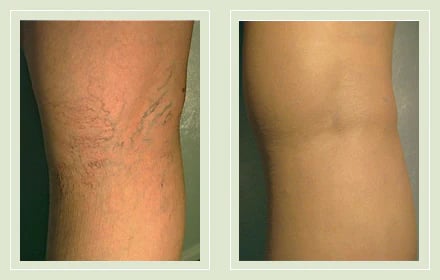 Airbrushed Leg Concealer