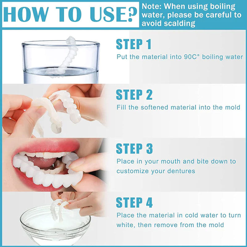 Snap On Smile Braces