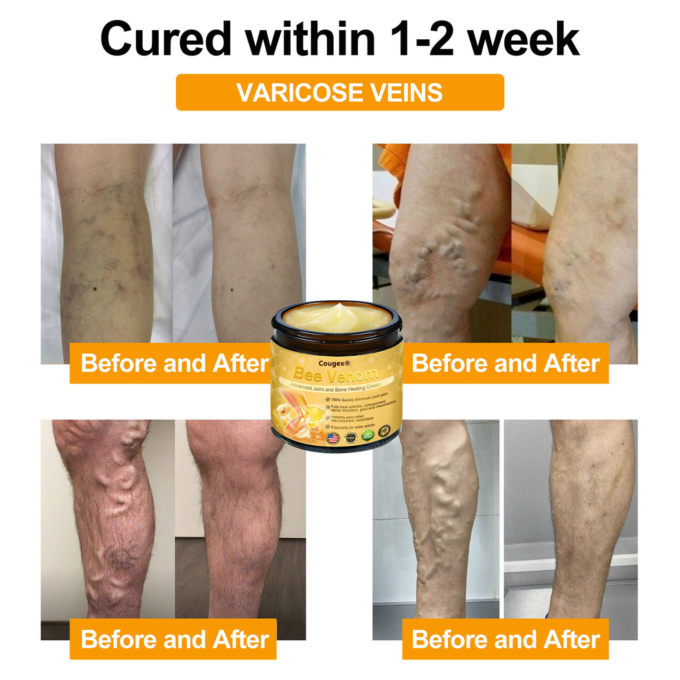 Bee Venom Healing Cream