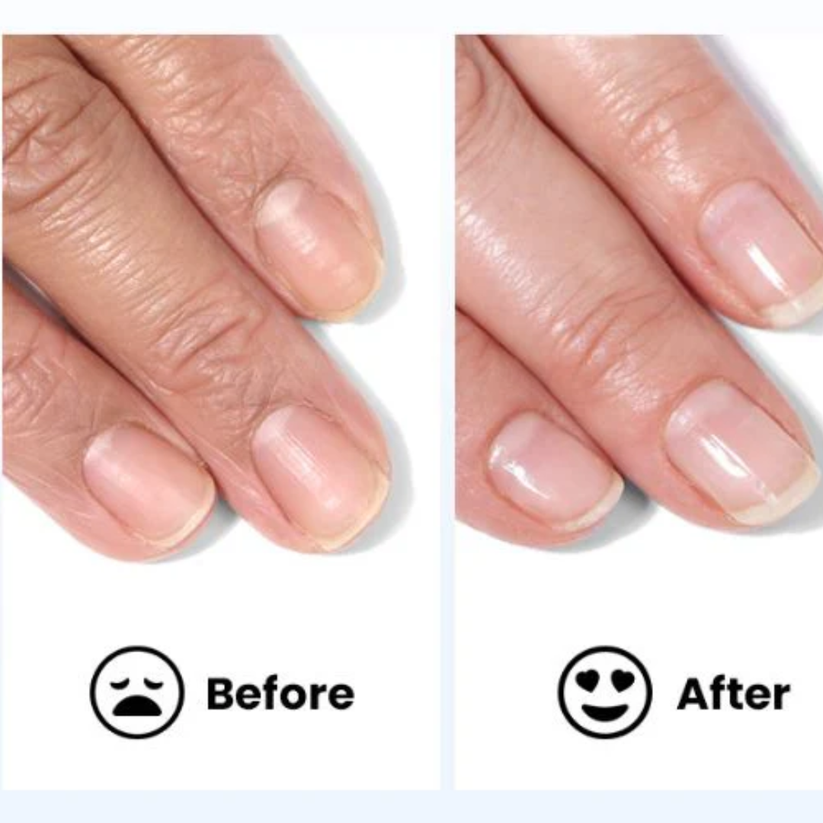 High-Gloss Quick-Dry Nail Oil - Salon-Perfect Shine, Anytime, Anywhere!