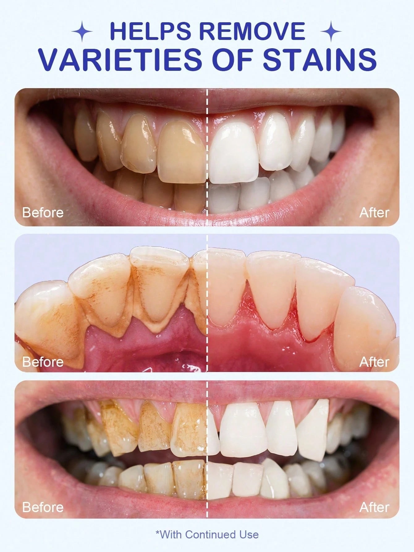 Huntly Teeth Whitening Powder