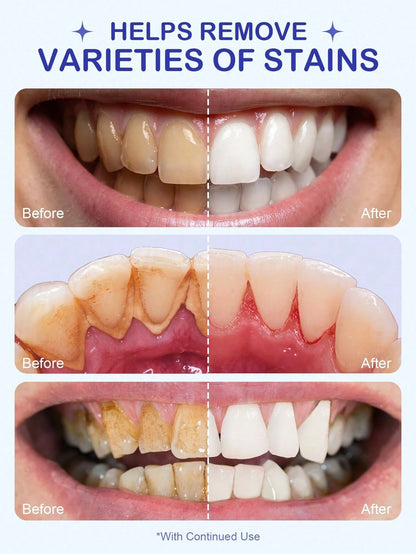 Huntly Teeth Whitening Powder