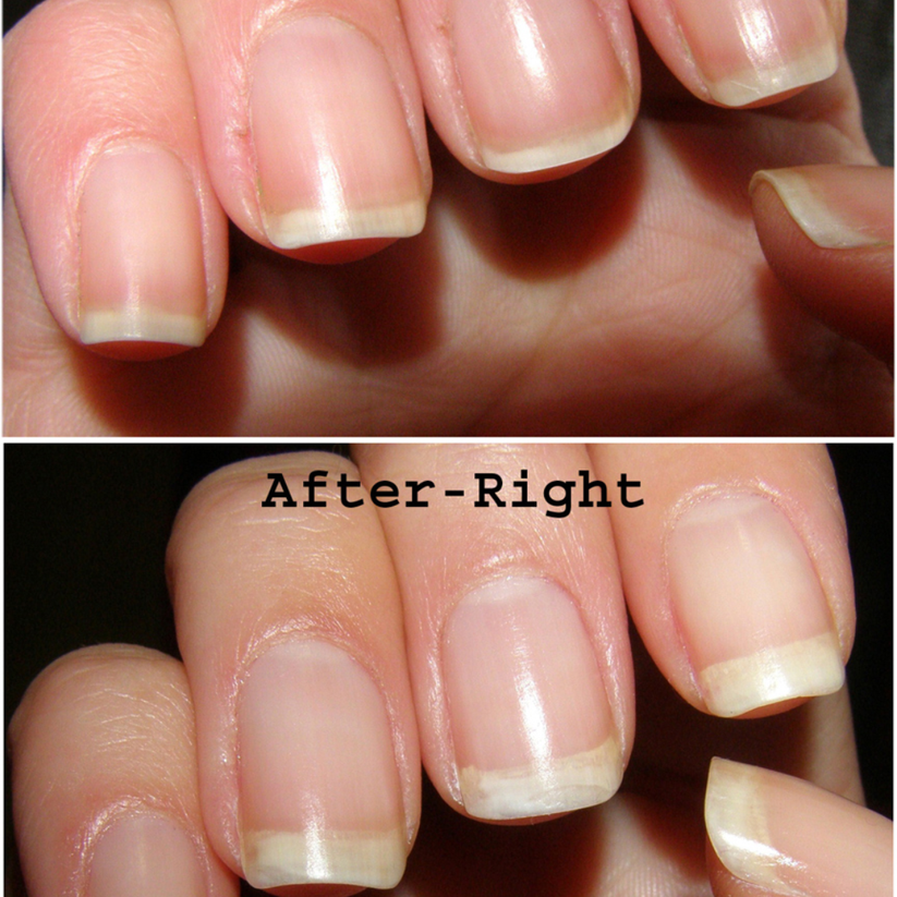 High-Gloss Quick-Dry Nail Oil - Salon-Perfect Shine, Anytime, Anywhere!