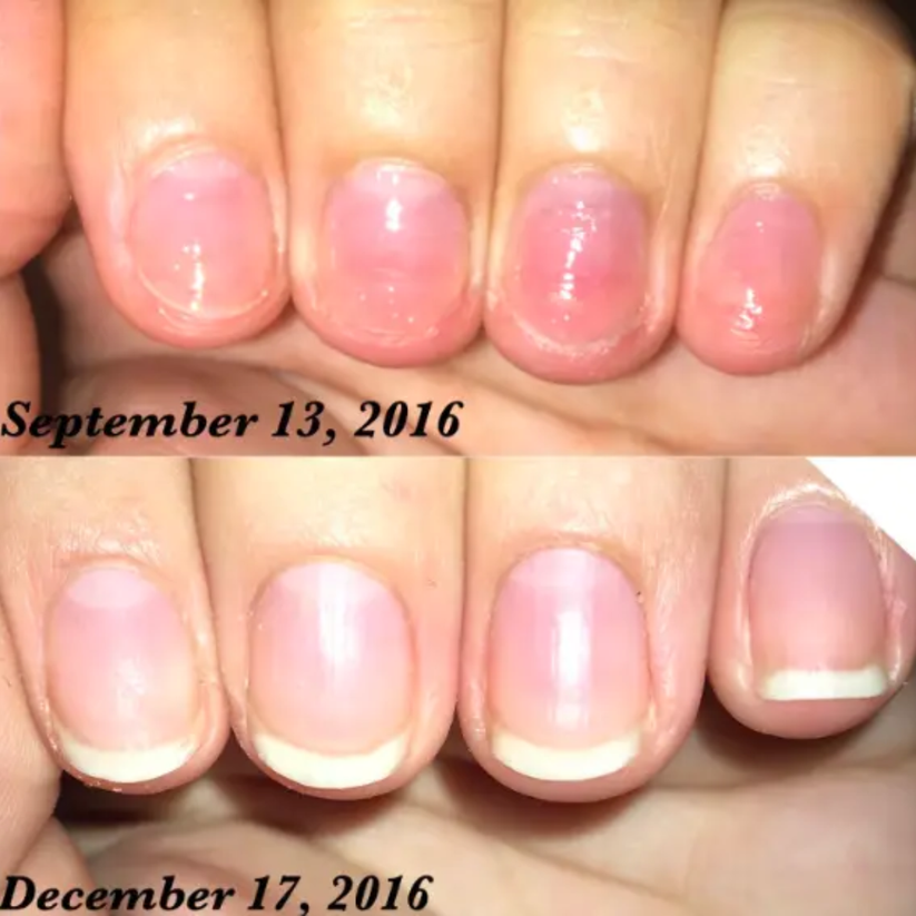 High-Gloss Quick-Dry Nail Oil - Salon-Perfect Shine, Anytime, Anywhere!