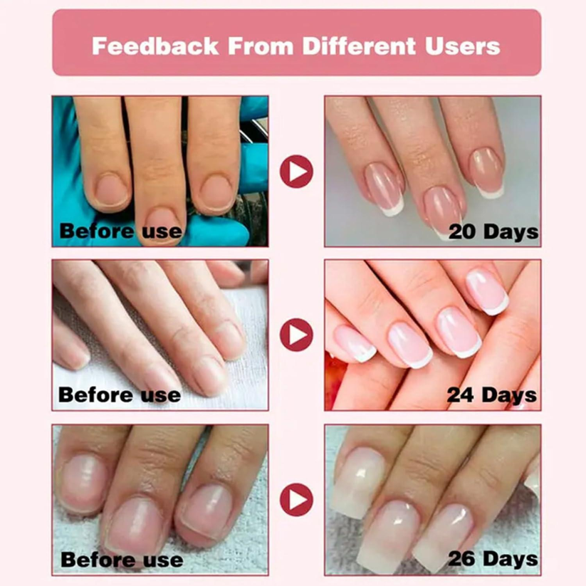 High-Gloss Quick-Dry Nail Oil - Salon-Perfect Shine, Anytime, Anywhere!