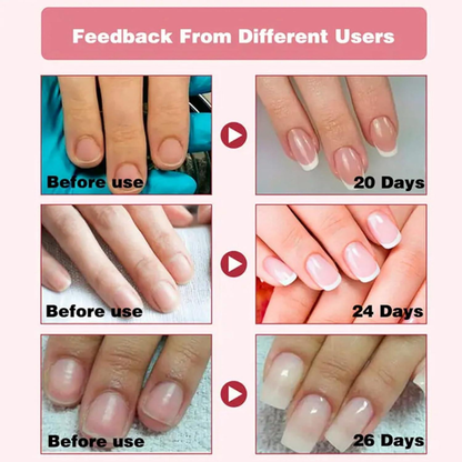 High-Gloss Quick-Dry Nail Oil - Salon-Perfect Shine, Anytime, Anywhere!