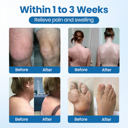BPC-157 Joint Repair Cream