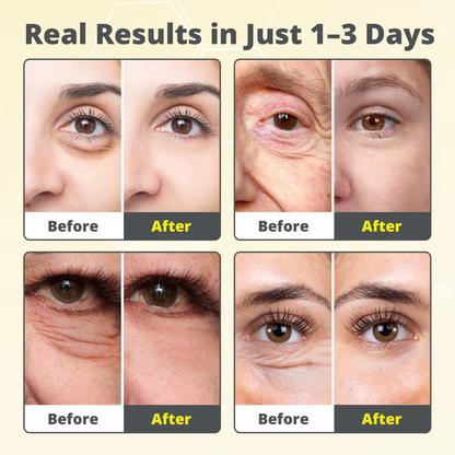 The 7-Day V-Line Shot: Vita A Retinal Tightening Serum