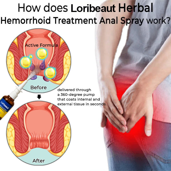 Hemorrhoid Treatment Anal Spray