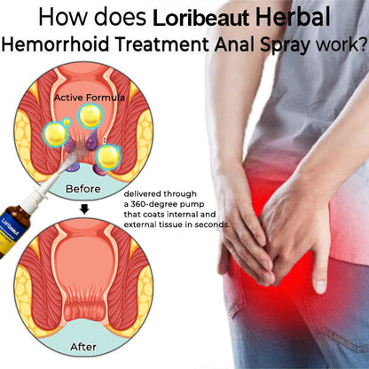 Hemorrhoid Treatment Anal Spray