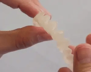 Snap On Smile Braces