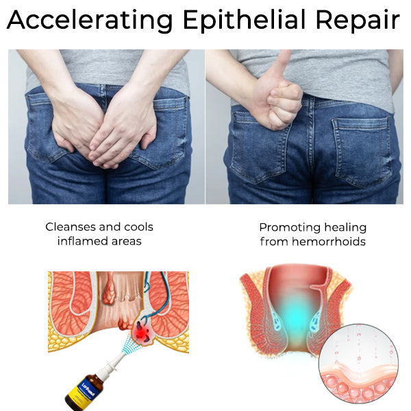 Hemorrhoid Treatment Anal Spray
