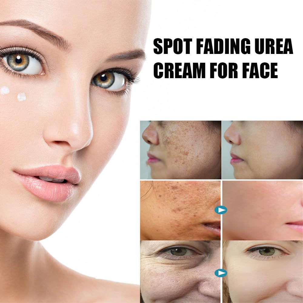 Spot Fading Urea Cream