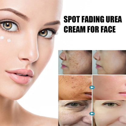 Spot Fading Urea Cream