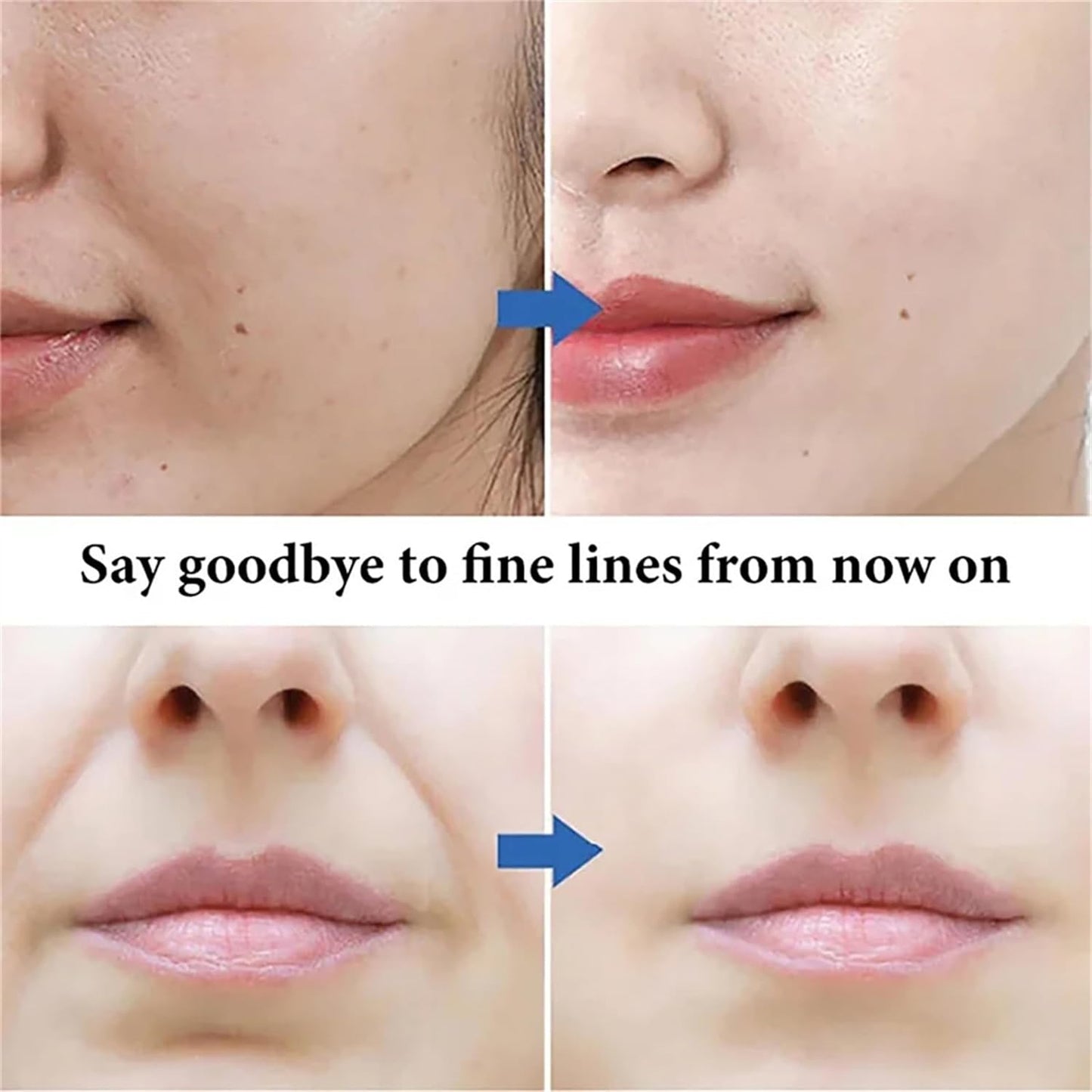 Spot Fading Urea Cream
