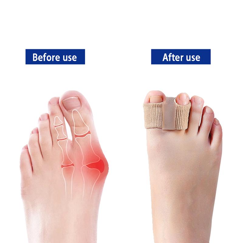 Orthopedic Soft Silicone Toe Separator & Corrector