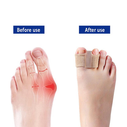 Orthopedic Soft Silicone Toe Separator & Corrector