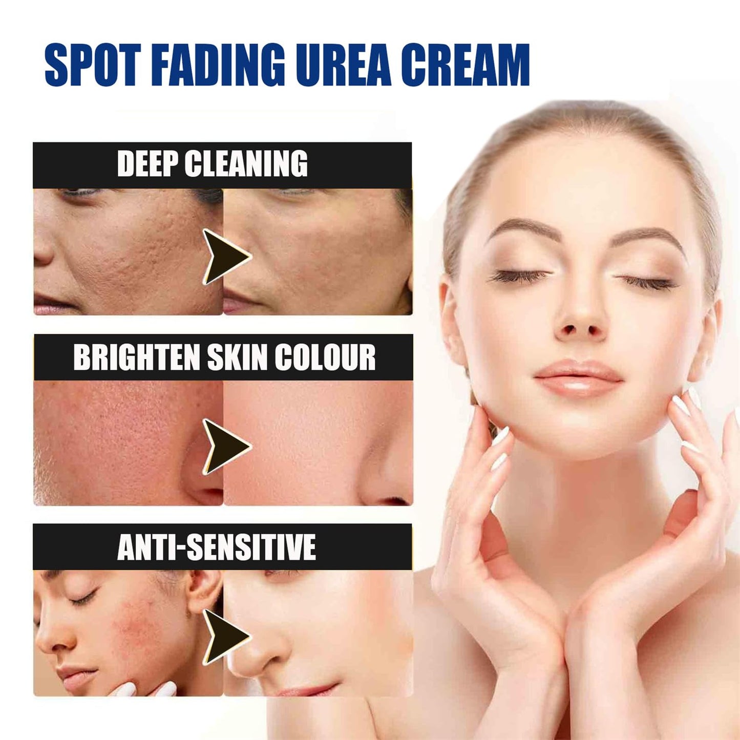 Spot Fading Urea Cream