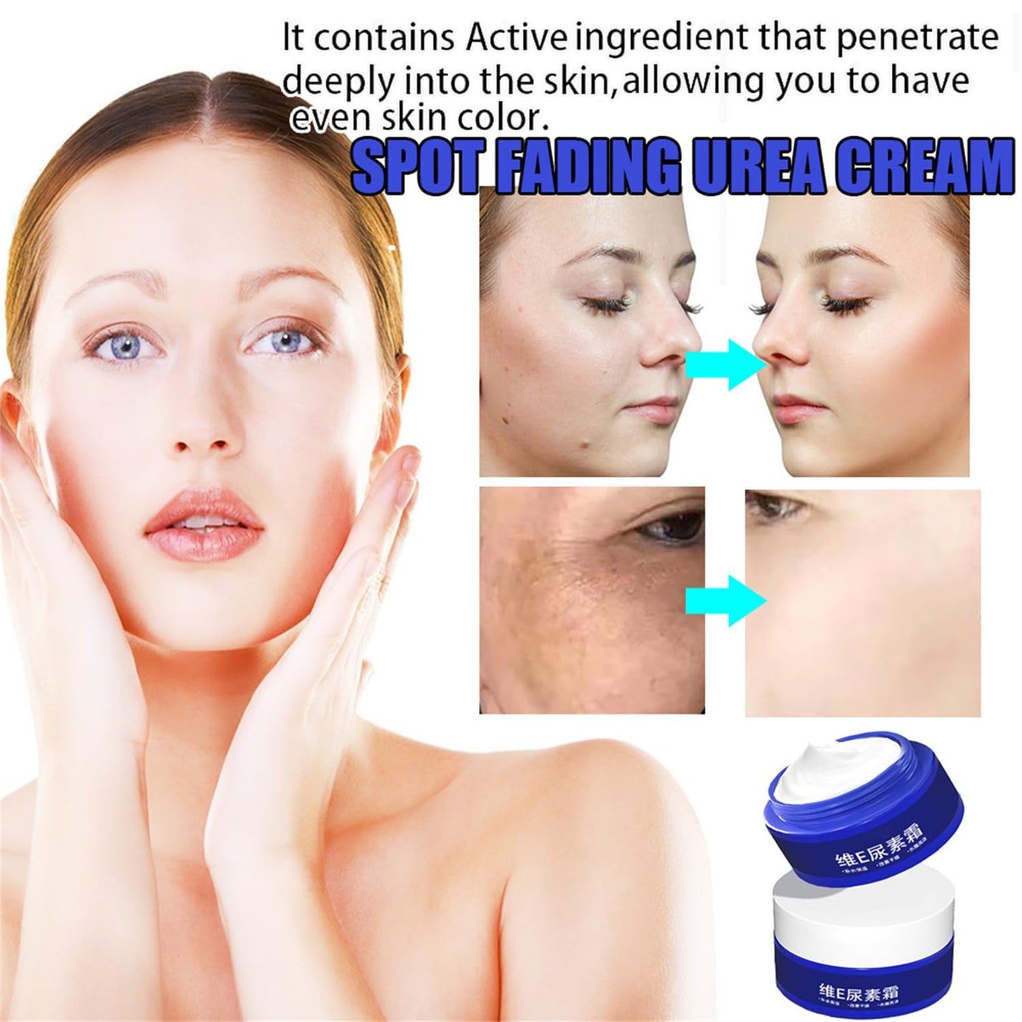 Spot Fading Urea Cream