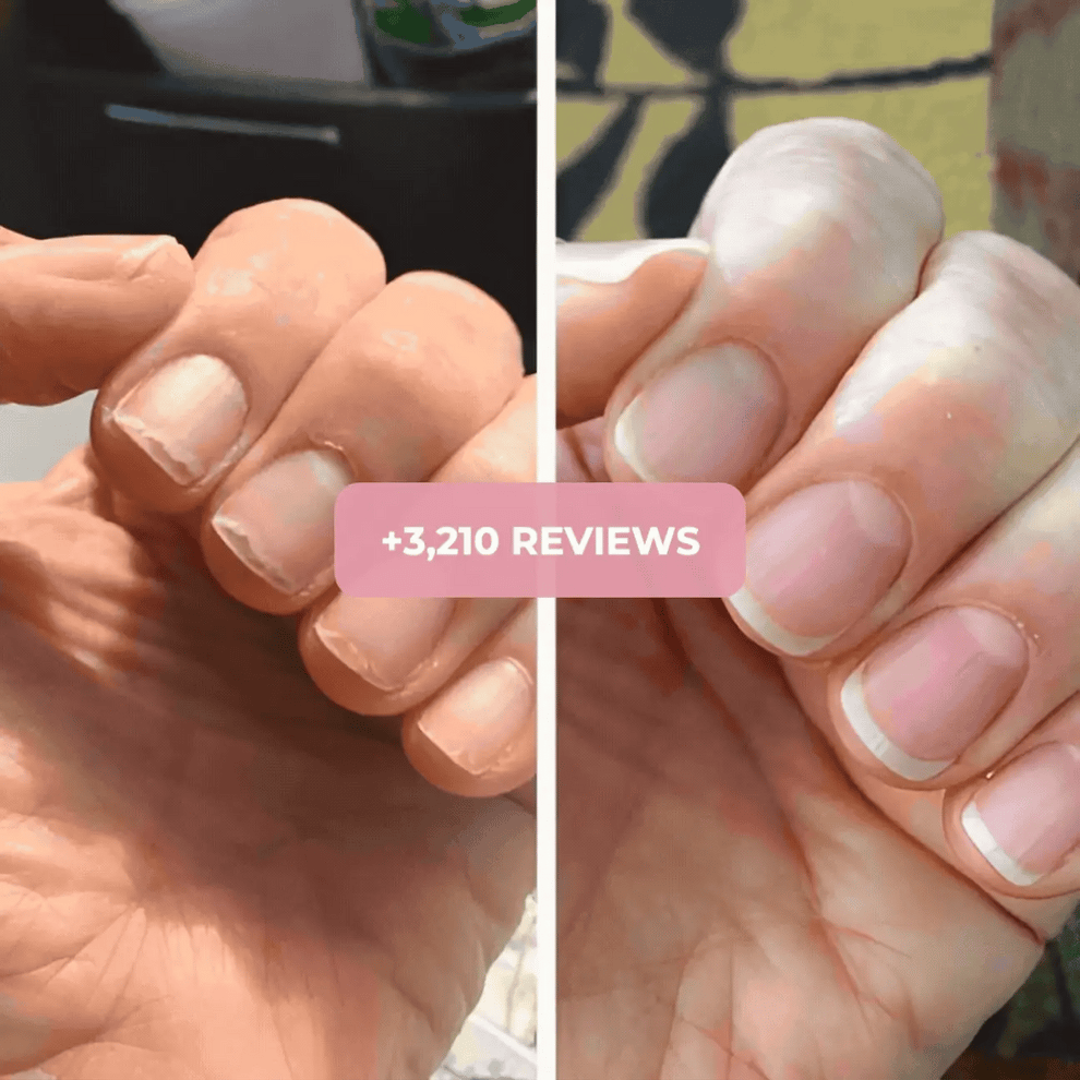 Nail Growth Oil