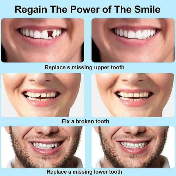 Moldable False Teeth (PACK OF 2)