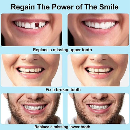 Moldable False Teeth (PACK OF 2)