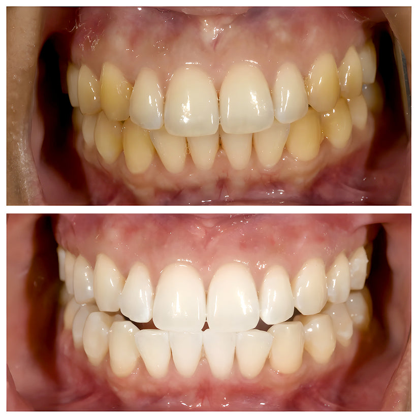 2 PCs Niacinamide TriBright ToothPaste
