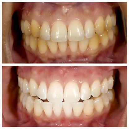 2 PCs Niacinamide TriBright ToothPaste