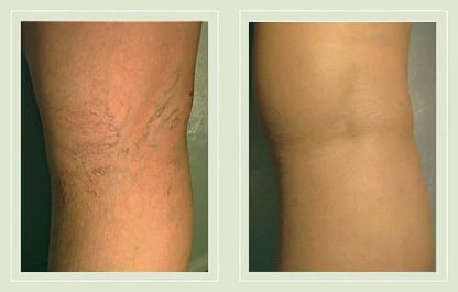 Airbrushed Leg Concealer