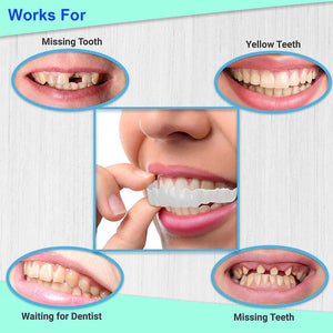 Snap On Smile Braces