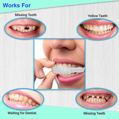 Snap On Smile Braces