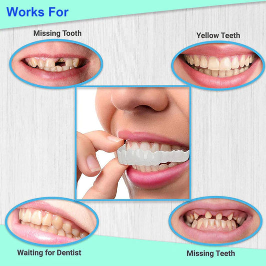 Snap On Smile Braces